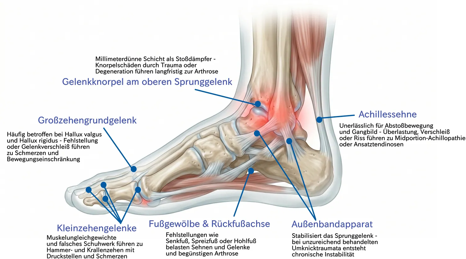 Anatomie von Fuß und Sprunggelenk – Gelenkknorpel, Achillessehne, Großzehengrundgelenk, Fußgewölbe und Außenbandapparat