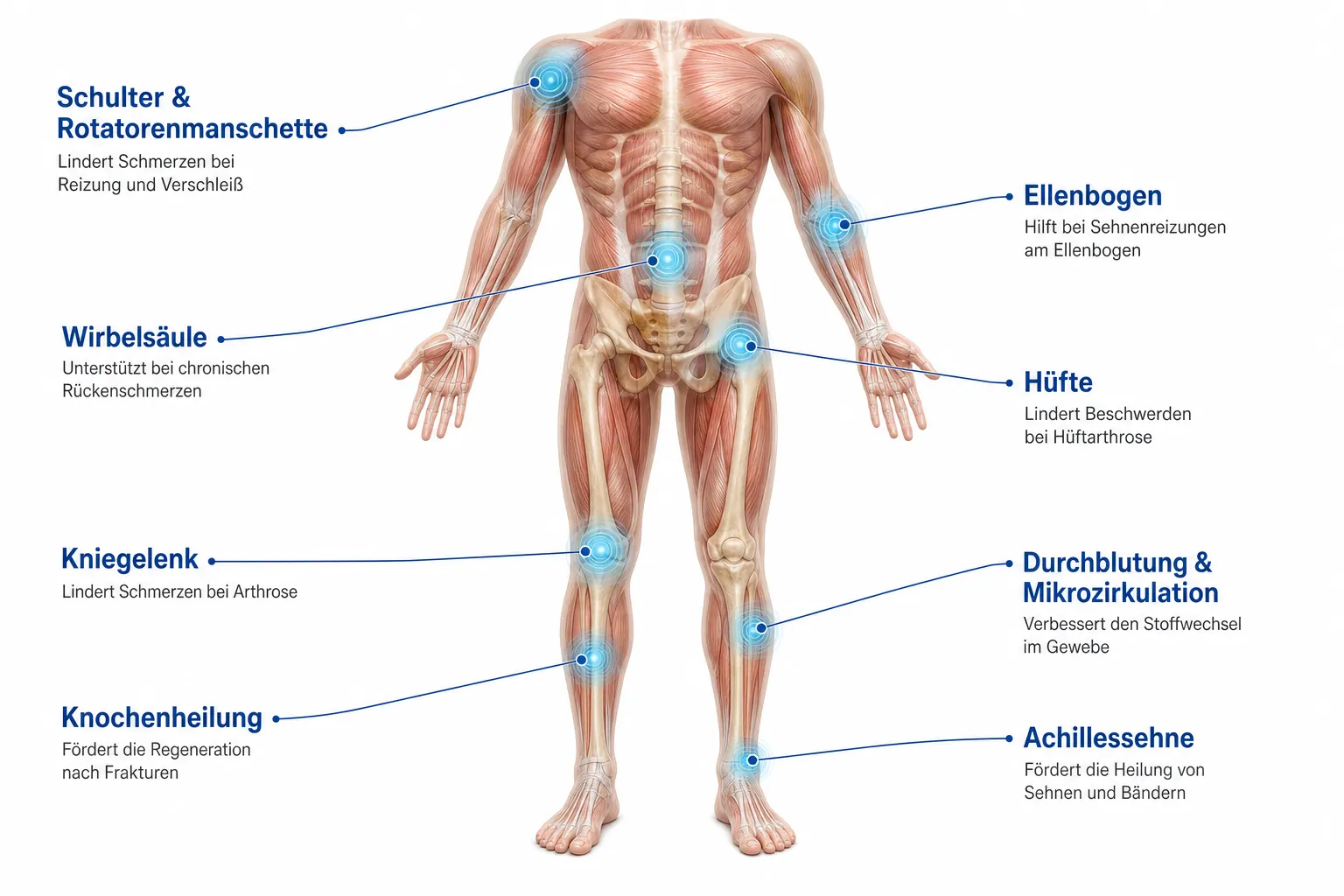 Anatomische Darstellung typischer Behandlungszonen der Magnetfeldtherapie – Schulter, Wirbelsäule, Ellenbogen, Hüfte, Kniegelenk, Knochenheilung, Achillessehne und Mikrozirkulation
